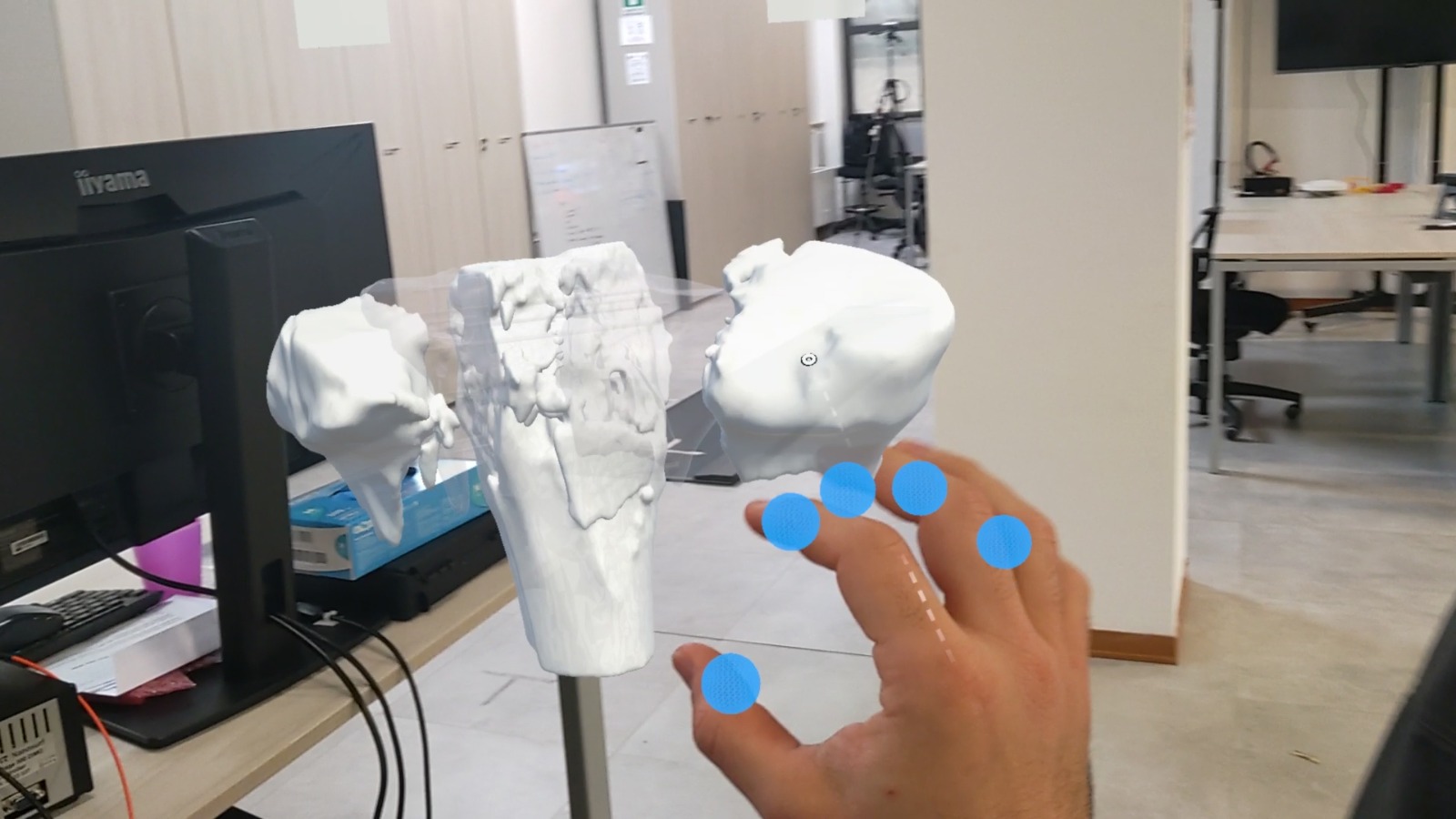 feedback tattile e realtà integrata chirurgia